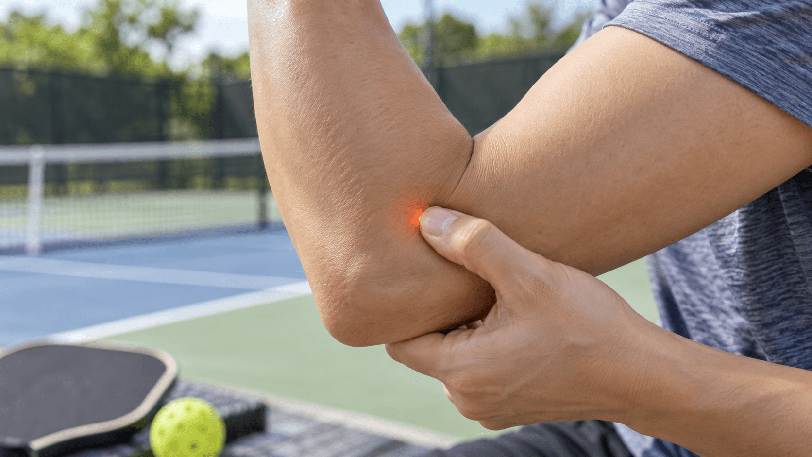 Phong trào Pickleball tăng mạnh: cảnh báo đau khuỷu tay, cổ tay và cách chăm sóc